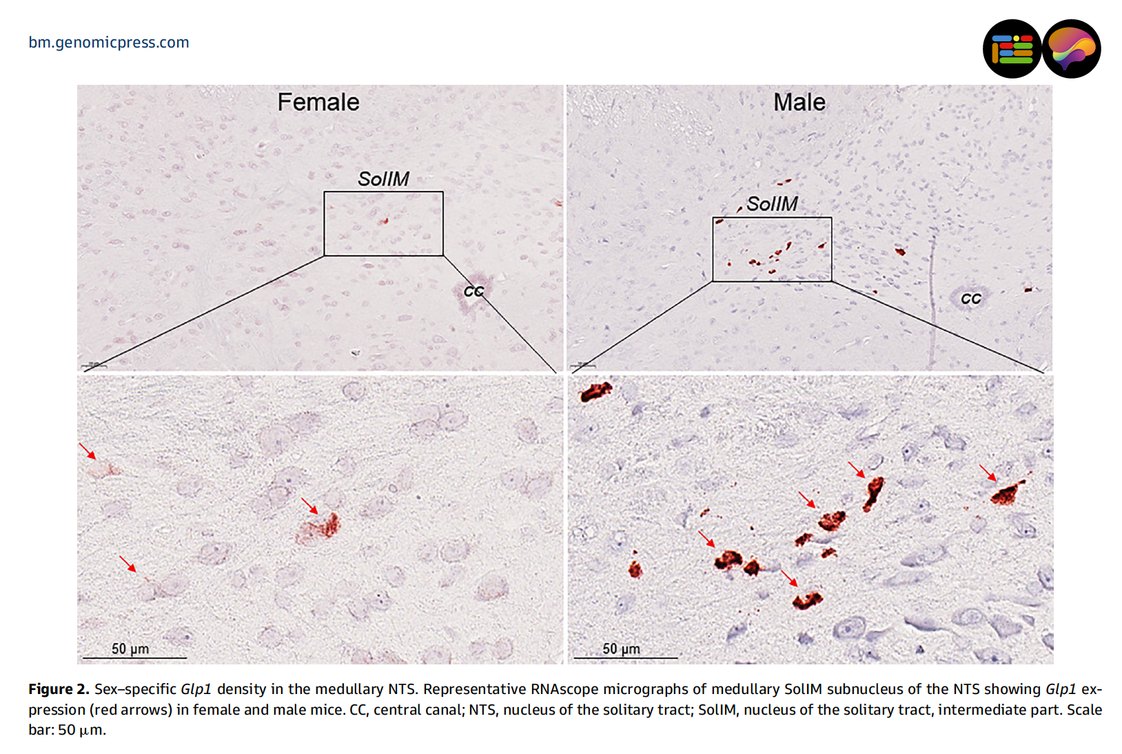 Sex-specific brain atlas of GLP-1 reveals why weight-loss drugs may work differently in females and males