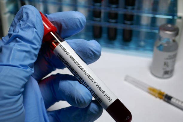 Sexual Health Awareness Month: The Importance of HIV and STI Testing